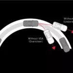 Vehicle Stability Assist (VSA)